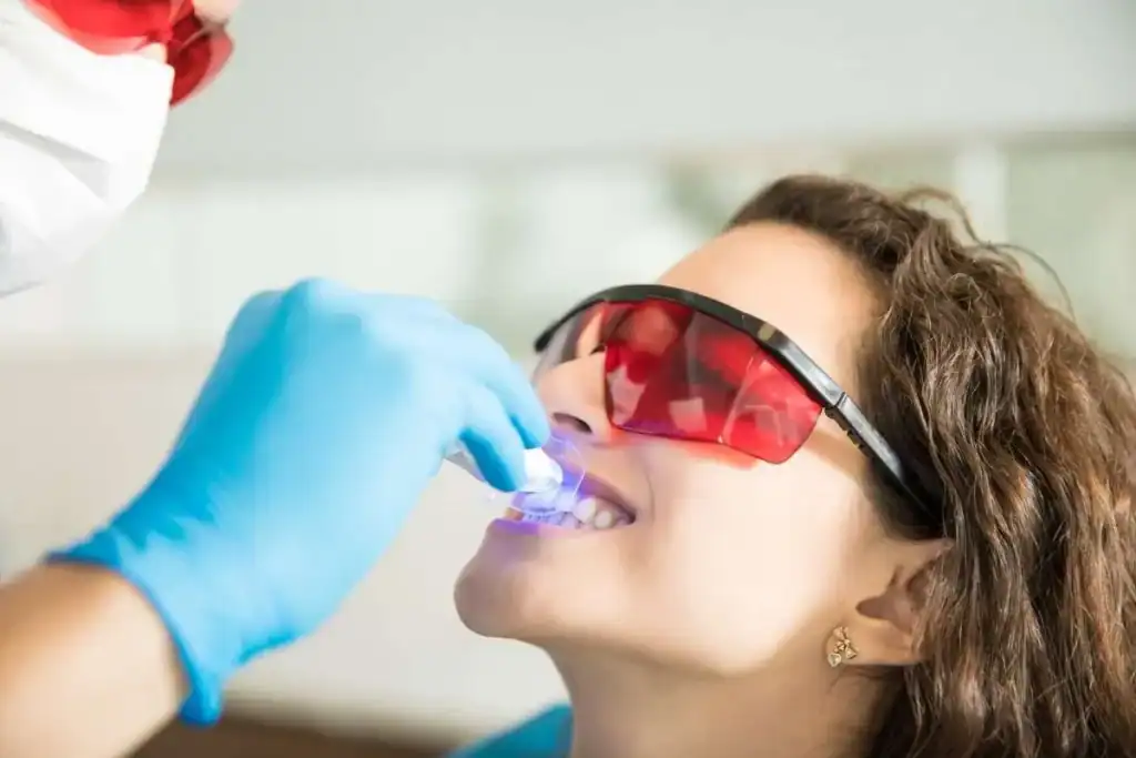 Laser Teeth Whitening FAQs Biggleswade &ndash; Your Ultimate Guide Biggleswade